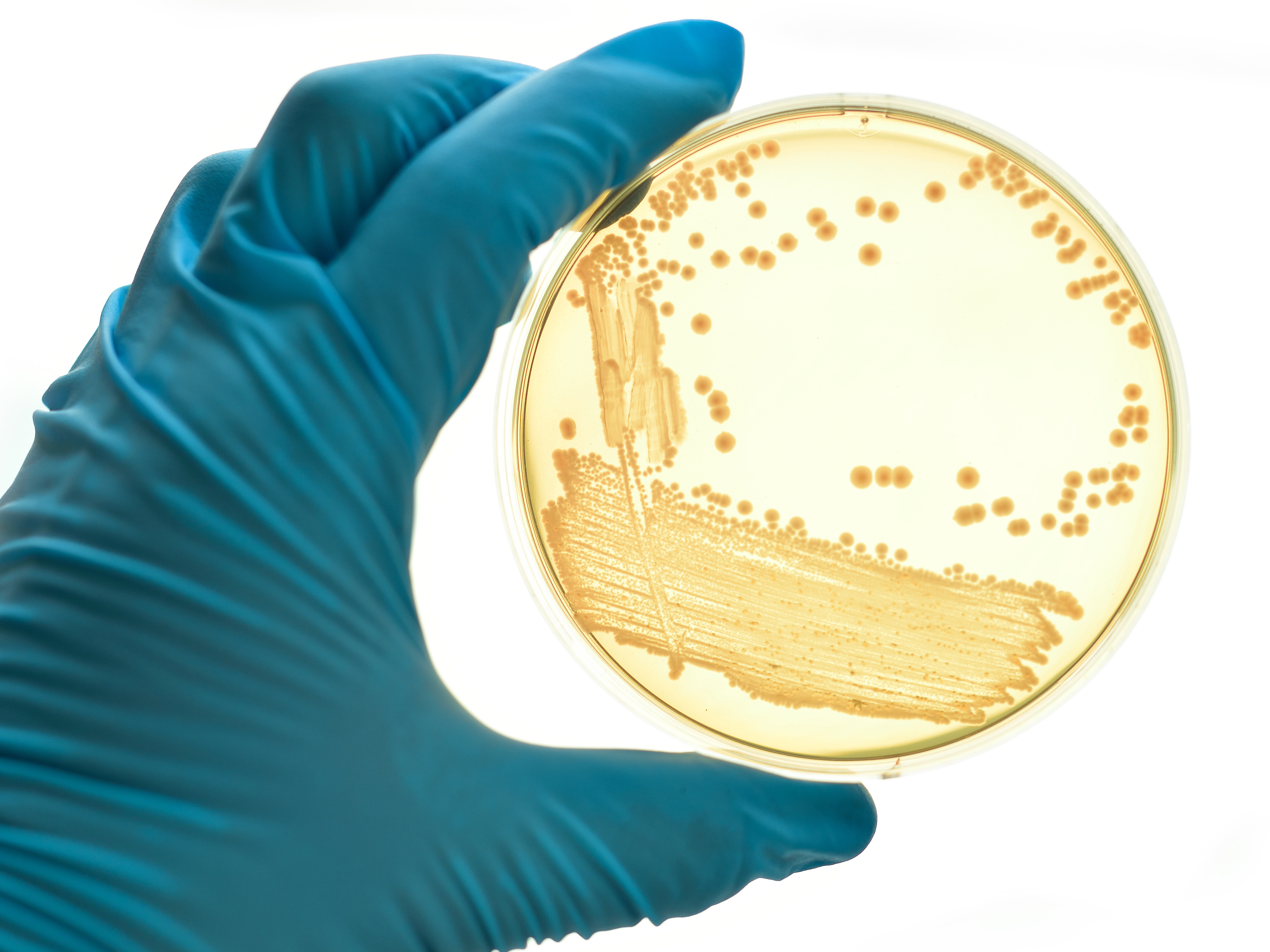 USP <85> Bacterial Endotoxin Test