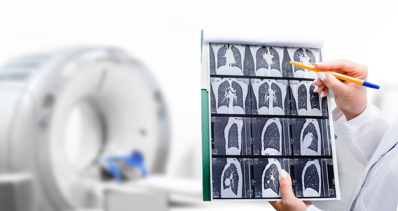 SPECT-CT and PET-CT Imaging