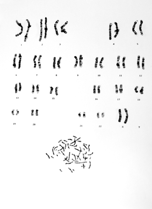 Chromosomal Characterization
