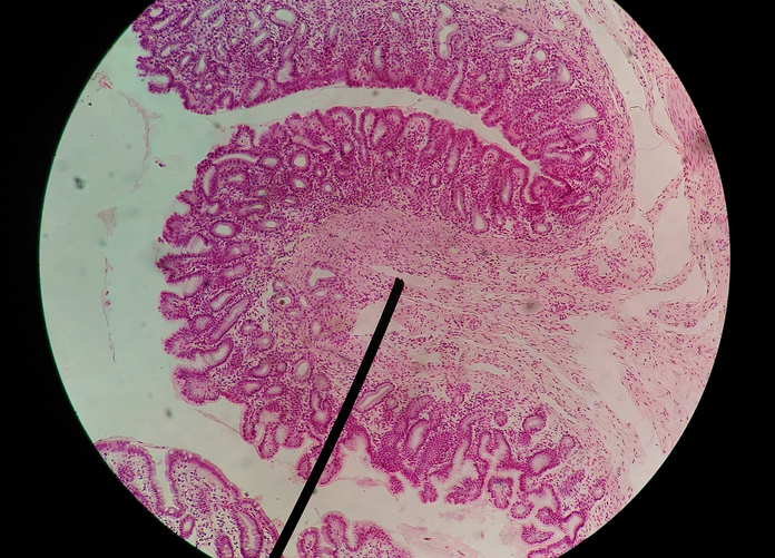 Trichrome Staining
